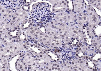 AEBP1 Rabbit Polyclonal Antibody
