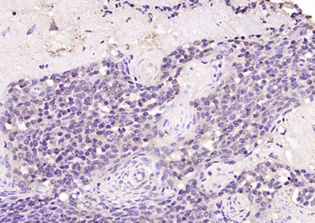 RYBP Rabbit Polyclonal Antibody