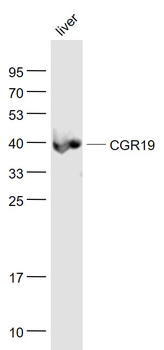CGR19 Rabbit Polyclonal Antibody