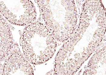 NUP160 Rabbit Polyclonal Antibody