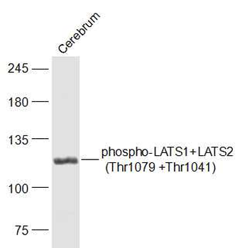 Phospho-LATS1+LATS2 (Thr1079 +Thr1041) Rabbit Polyclonal Antibody