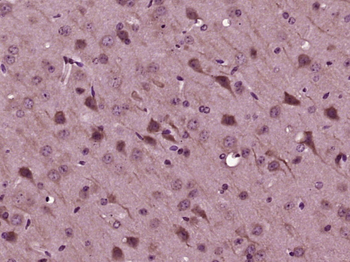 SRPK2 Rabbit Polyclonal Antibody