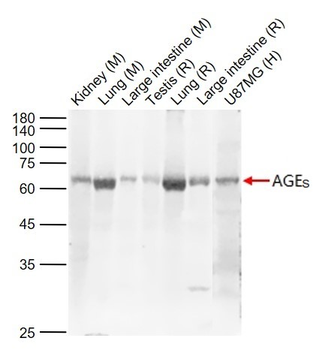 AGEs Rabbit Polyclonal Antibody