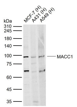 MACC1 Rabbit Polyclonal Antibody