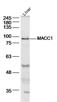 MACC1 Rabbit Polyclonal Antibody