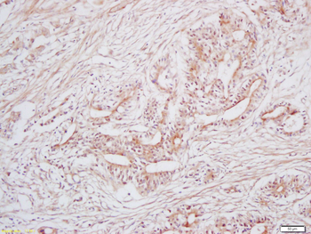 MACC1 Rabbit Polyclonal Antibody