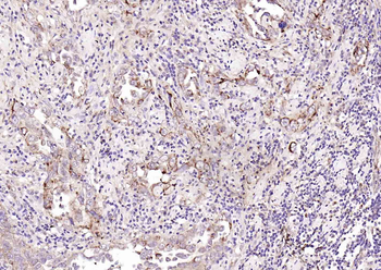 CDKN3 Rabbit Polyclonal Antibody