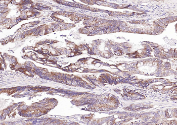 CDKN3 Rabbit Polyclonal Antibody