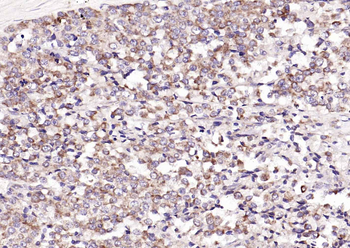 CDKN3 Rabbit Polyclonal Antibody