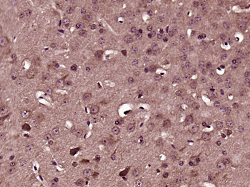 ADAM23 Rabbit Polyclonal Antibody