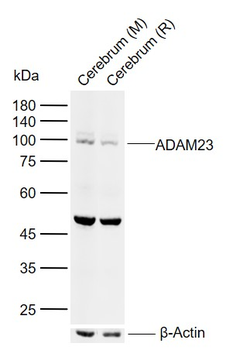 ADAM23 Rabbit Polyclonal Antibody