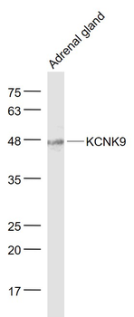 KCNK9 Rabbit Polyclonal Antibody
