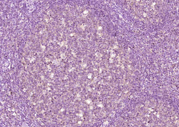 CDCA7L Rabbit Polyclonal Antibody