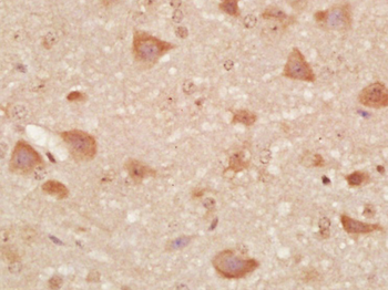 DAL1/EPB41L3 Rabbit Polyclonal Antibody