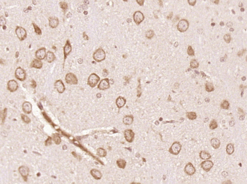 DAL1/EPB41L3 Rabbit Polyclonal Antibody