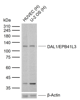DAL1/EPB41L3 Rabbit Polyclonal Antibody