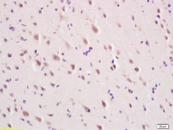 MFSD2A Rabbit Polyclonal Antibody