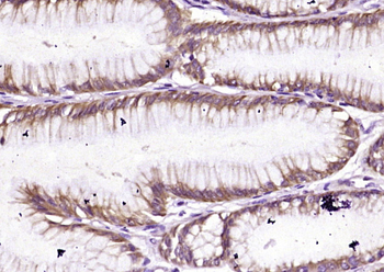 TCHP Rabbit Polyclonal Antibody