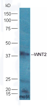 WNT2 Rabbit Polyclonal Antibody
