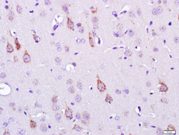 SEMA6D Rabbit Polyclonal Antibody