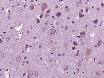 RAC1 + RAC2 Rabbit Polyclonal Antibody