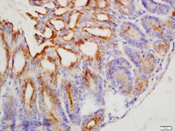 TFF1 Rabbit Polyclonal Antibody