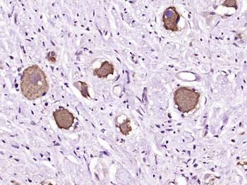 HRH1 Rabbit Polyclonal Antibody