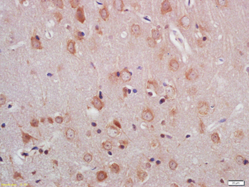 PNPLA6/NTE Rabbit Polyclonal Antibody