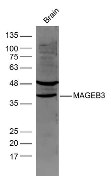 MAGEB3 Rabbit Polyclonal Antibody