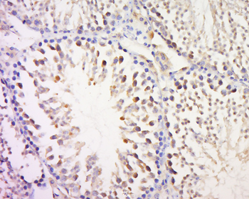 MAGEB3 Rabbit Polyclonal Antibody