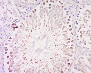 MAGEB3 Rabbit Polyclonal Antibody