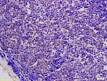 AMPKB1 + PRKAB2 Rabbit Polyclonal Antibody