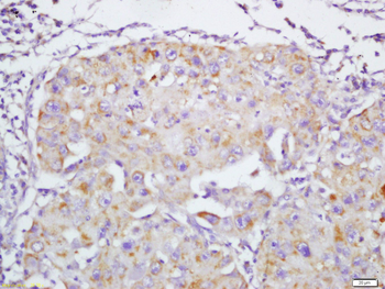 ANT-1 Rabbit Polyclonal Antibody