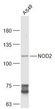 CARD15/NOD2 Rabbit Polyclonal Antibody