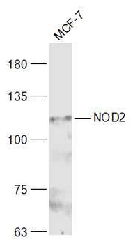 CARD15/NOD2 Rabbit Polyclonal Antibody