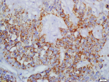 CARD7/NALP1 Rabbit Polyclonal Antibody