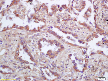 P53AIP1 Rabbit Polyclonal Antibody
