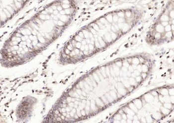 Cyclophilin F Rabbit Polyclonal Antibody