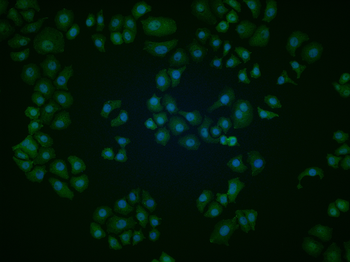 NUF2 Rabbit Polyclonal Antibody