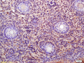 NUF2 Rabbit Polyclonal Antibody