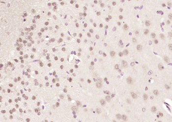 CHMP4B+CHMP4C Rabbit Polyclonal Antibody