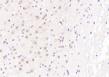 NUSAP1 Rabbit Polyclonal Antibody