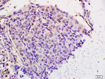 NUSAP1 Rabbit Polyclonal Antibody