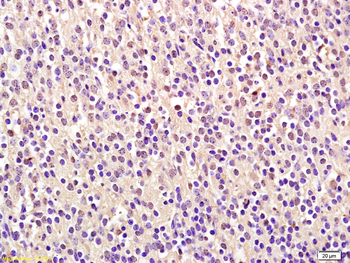 NUSAP1 Rabbit Polyclonal Antibody