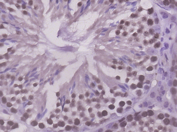 PRC1 Rabbit Polyclonal Antibody