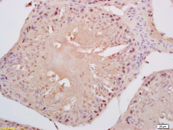 Cyclin B3 Rabbit Polyclonal Antibody