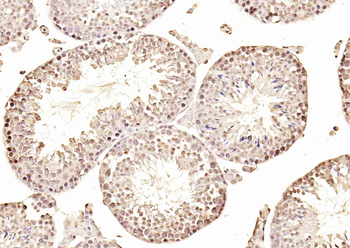 MOBKL2B Rabbit Polyclonal Antibody