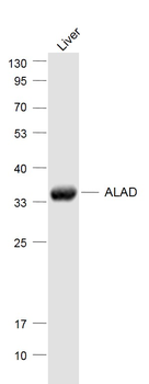 ALAD Rabbit Polyclonal Antibody