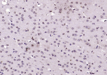STK36 Rabbit Polyclonal Antibody