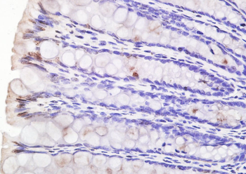 STK36 Rabbit Polyclonal Antibody